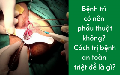 Bệnh trĩ có nên phẫu thuật không? Cách trị bệnh an toàn triệt để là gì?