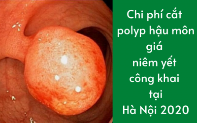Chi phí cắt polyp hậu môn giá niêm yết công khai tại Hà Nội 2020