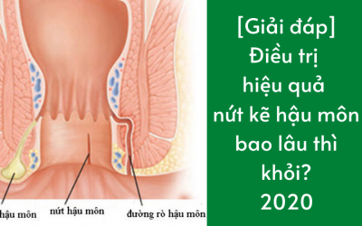 [Giải đáp] Điều trị hiệu quả nứt kẽ hậu môn bao lâu thì khỏi?