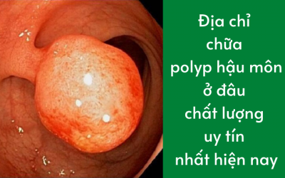 Địa chỉ chữa polyp hậu môn ở đâu chất lượng uy tín nhất hiện nay