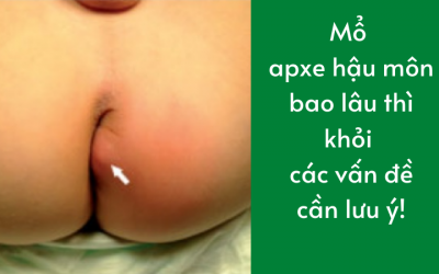 Mổ apxe hậu môn bao lâu thì khỏi các vấn đề cần lưu ý!