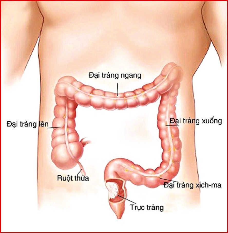 Nhận biết hậu môn trực tràng là gì?