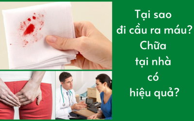 Tại sao đi cầu ra máu? Chữa tại nhà có hiệu quả?