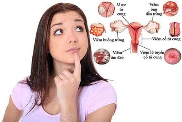 U xơ tử cung kéo theo các bệnh phụ khoa