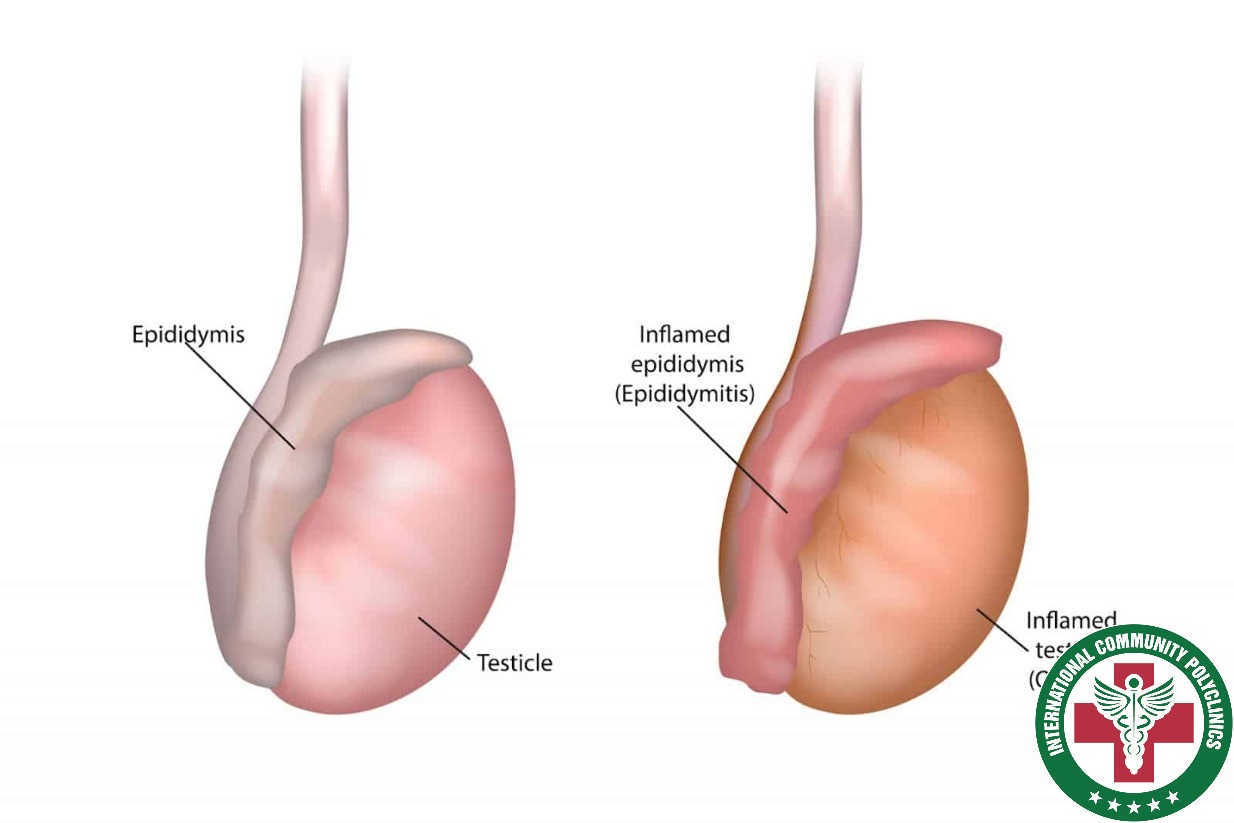 Do mắc các bệnh ung thư