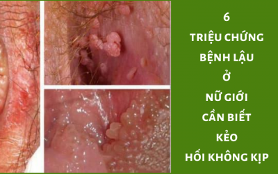 { Dấu Hiệu Bệnh Lậu Ở Nữ } – Danh Sách 6 Triệu Chứng Cần Lưu Ý