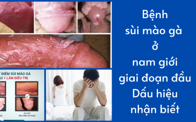 Bệnh sùi mào gà ở nam giới giai đoạn đầu: Dấu hiệu nhận biết