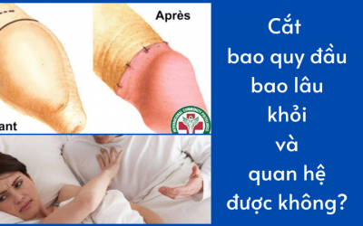 Cắt bao quy đầu bao lâu thì khỏi và có quan hệ được không?