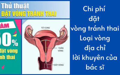 Chi phí đặt vòng tránh thai: Loại vòng, địa chỉ và lời khuyên của bác sĩ