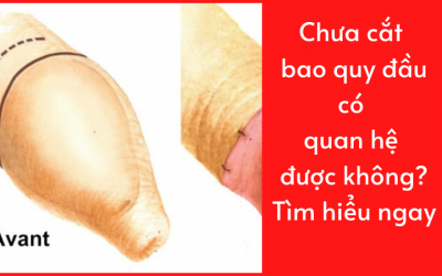 Chưa cắt bao quy đầu có quan hệ được không? Tìm hiểu ngay