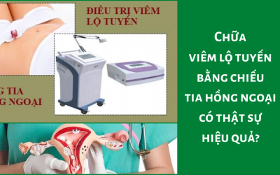 Chữa viêm lộ tuyến bằng chiếu tia hồng ngoại có thật sự hiệu quả?
