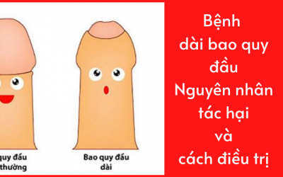 Bệnh dài bao quy đầu: Nguyên nhân, tác hại và cách điều trị