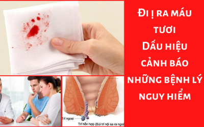 Đi ị ra máu tươi: Dấu hiệu cảnh báo những bệnh lý nguy hiểm