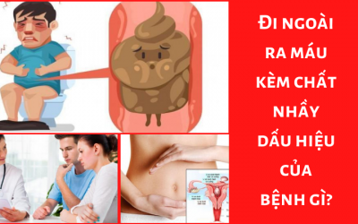 Đi ngoài ra máu kèm chất nhầy là dấu hiệu của bệnh gì?