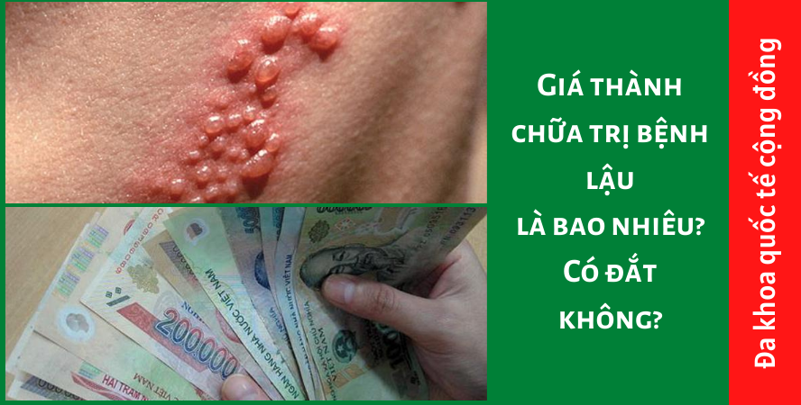 Giá thành chữa trị bệnh lậu là bao nhiêu? Có đắt không?