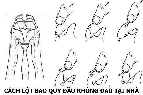 Tự lột bao quy đầu