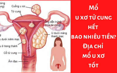 Mổ u xơ tử cung hết bao nhiêu tiền? Địa chỉ mổ u xơ tốt