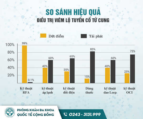 Điều trị viêm lộ tuyến bằng sóng cao tần RFA là gì?