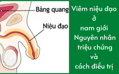 Viêm niệu đạo ở nam giới: Nguyên nhân, triệu chứng và cách điều trị