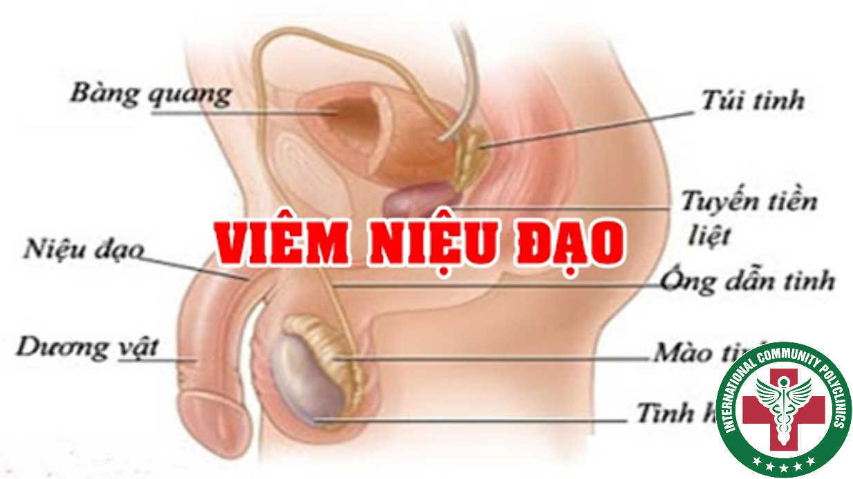 Viêm niệu đạo ở nam giới