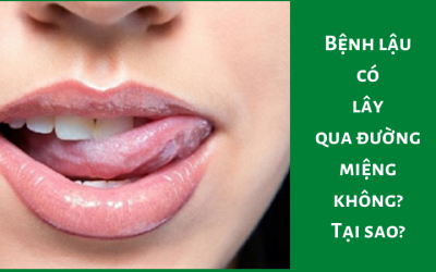 Bệnh lậu có lây qua đường miệng không? Tại sao?