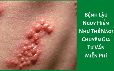 Bệnh Lậu Nguy Hiểm Như Thế Nào? – Bác Sĩ Nam Phụ Khoa Tư Vấn