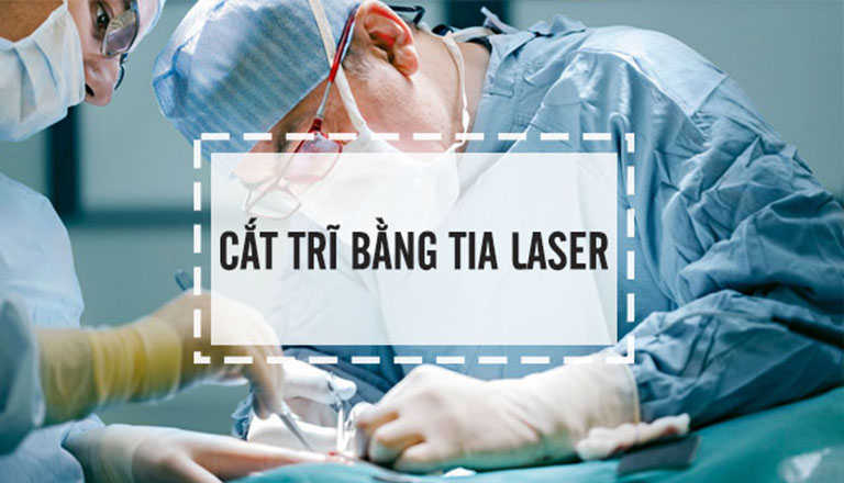 Điều trị sùi mào gà bằng phương pháp đốt laser