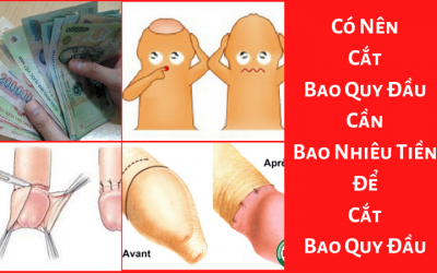 Có Nên Cắt Bao Quy Đầu – Cần Bao Nhiêu Tiền Để Cắt Bao Quy Đầu