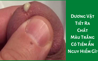 Dương Vật Tiết Ra Chất Màu Trắng Có Tiềm Ẩn Nguy Hiểm Gì?