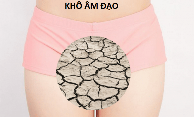 Khô âm đạo