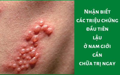 Nhận biết các triệu chứng đầu tiên lậu ở nam giới cần chữa trị ngay