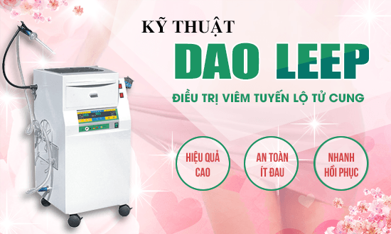 Phương pháp leep bao nhiêu ngày thì quan hệ được?