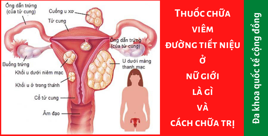 Thuốc chữa viêm đường tiết niệu ở nữ giới loại nào hiệu quả?