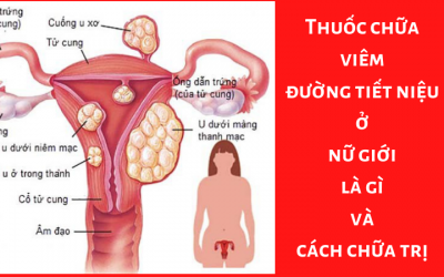 Thuốc chữa viêm đường tiết niệu ở nữ giới là gì và cách chữa trị hiệu quả
