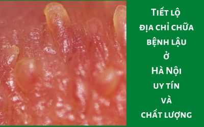 { Địa Chỉ Chữa Bệnh Lậu } Danh Sách Phòng Khám Tại Hà Nội