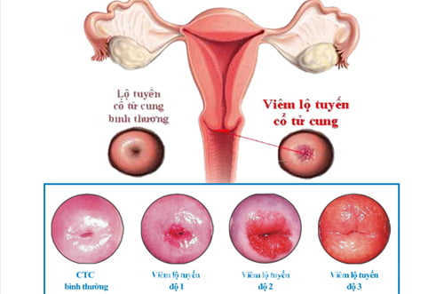 Cấp độ tình trạng của bệnh