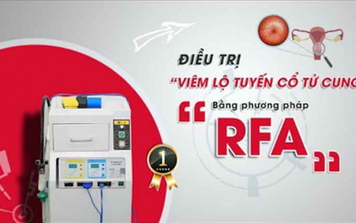 Ứng dụng sóng cao tần RFA trong điều trị viêm lộ tuyến
