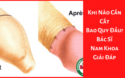 Khi Nào Cần Cắt Bao Quy Đầu? – Bác Sĩ Nam Khoa Giải Đáp