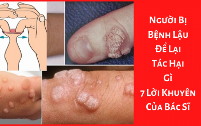 Người Bị Bệnh Lậu Để Lại Tác Hại Gì – 7 Lời Khuyên Của Bác Sĩ