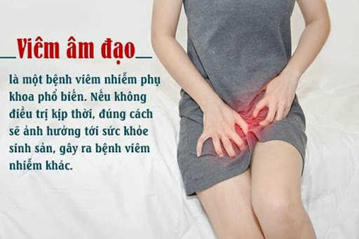 Sơ lược về viêm âm đạo