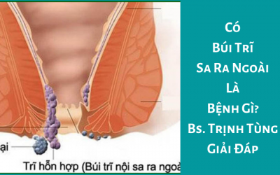 Có Búi Trĩ Sa Ra Ngoài Là Bệnh Gì? – Bs. Trịnh Tùng Giải Đáp