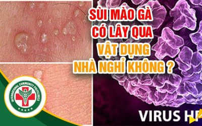 [ Sùi Mào Gà ] Anh Khoa Hùng, Bị lây sùi mào gà qua vật dụng nhà nghỉ