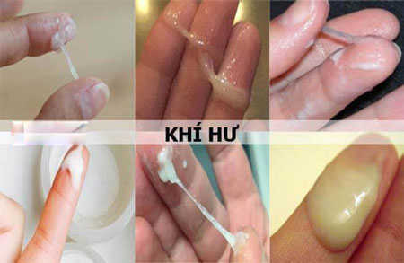 Khắc phục tình trạng khí hư sủi bọt nguyên nhân sinh lý