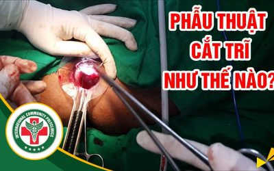 [Video Thực Tế] – Phẫu Thuật Cắt Trĩ Như Thế Nào?