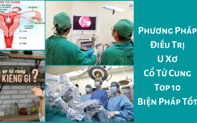 [ Phương Pháp Điều Trị U Xơ Cổ Tử Cung ] – Top 10 Biện Pháp Tốt
