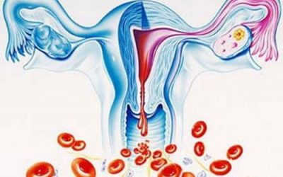 Bệnh Rong Kinh Có Nguy Hiểm Không? – Bác sĩ Tư Vấn