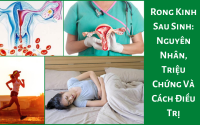 Rong Kinh Sau Sinh: Nguyên Nhân, Triệu Chứng Và Cách Điều Trị
