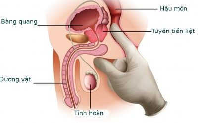 Khám Tiền Liệt Tuyến Ở Đâu Tốt – Top 10 Địa Chỉ Tốt Ở Hà Nội