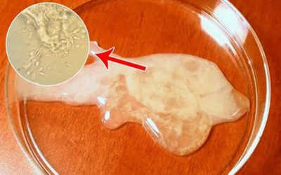 Tinh Trùng Loãng Nên Ăn Gì Và Không Nên Ăn Gì?