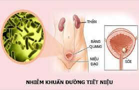 Nhiễm trùng đường tiết niệu